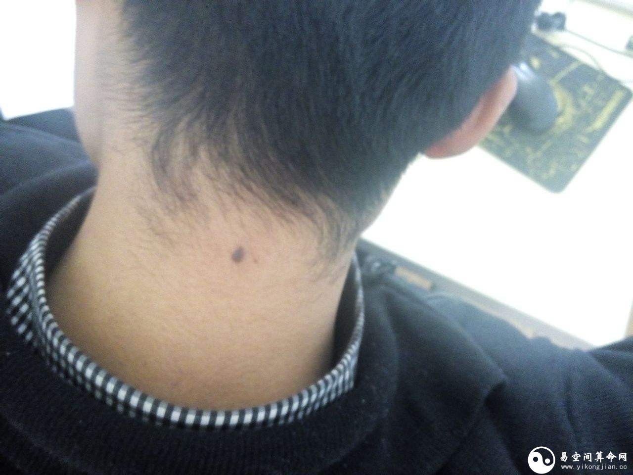 脖子上有痣的男人代表什么 脖頸上右側有長痣代表什么