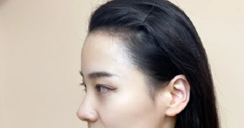 女性額頭寬大發(fā)際線高面相好不好？