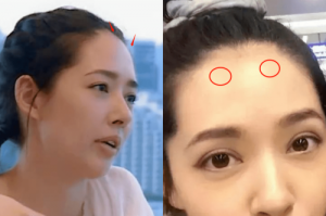 面相額頭有骨隆起說法
