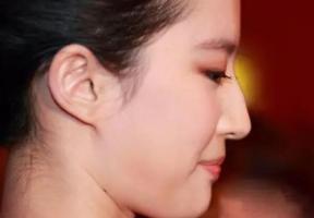 鼻梁上有個(gè)小駝峰的女人