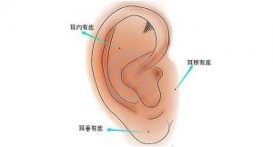耳朵有痣圖解對(duì)照表