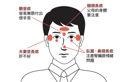面部哪些痣必須點掉